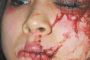Silence des médias face à la barbarie islamiste: une jeune fille a eu la bouche et l'oeil cousus pour avoir évoqué Jésus - © Europe-Israel