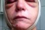 Une femme suédoise sauvagement agressée à cause de son Etoile de David. - © Europe-Israel