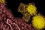 Comment décide-t-on du nom des virus' - © Slate .fr
