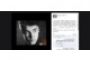 Justin Bieber : "Avec un peu de chance, Anne Franck aurait été une belieber" - © LCI.fr - People