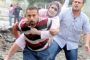 Une 3e explosion en Turquie: au moins 40 morts - © La Libre