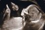 Une commission d'interruption de grossesse ? - &copy; Torah-Box